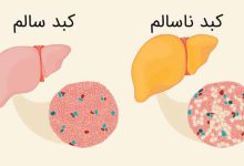 فرق چربی خون با کبد چرب